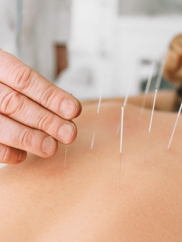 sports acupuncture