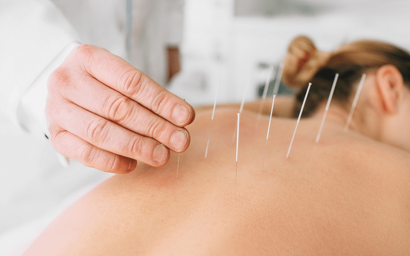 sports acupuncture